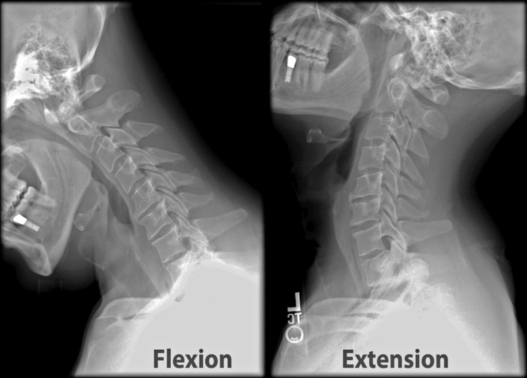 What X-Rays Reveal About Bone and Joint Injuries