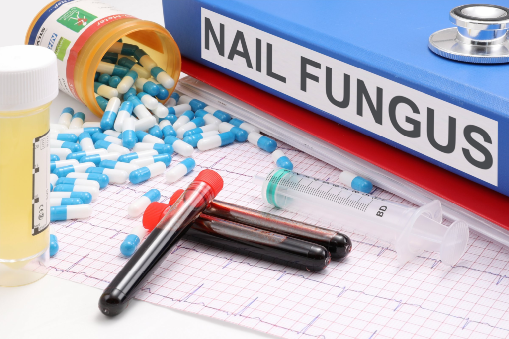 How to Spot Nail Fungus Before It Spreads