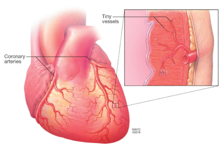 Understanding Vascular Problems and Their Connection to Heart Disease